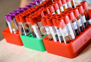stock-photo-49972512-blood-samples